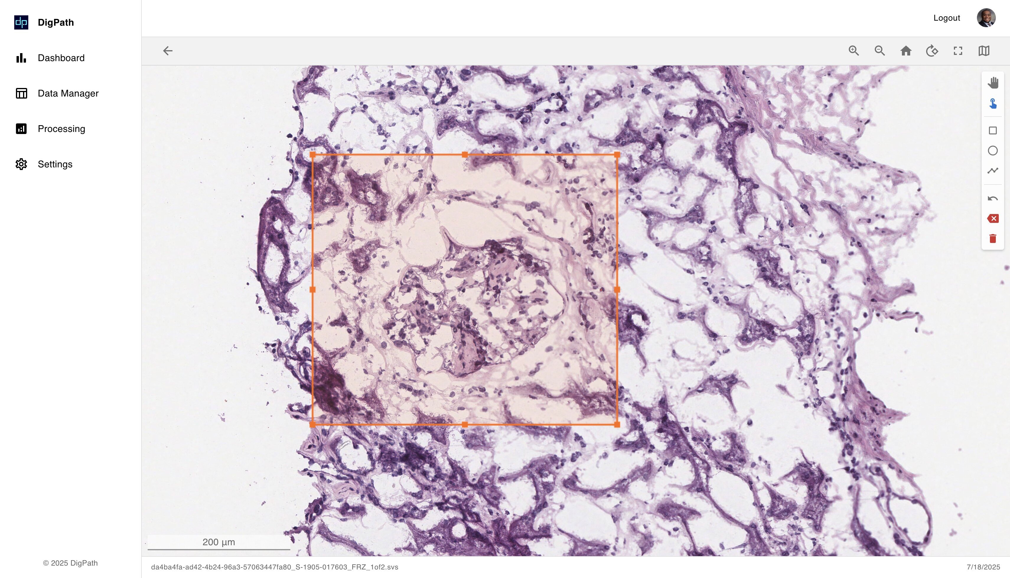 DigPath Frozen Section - High-resolution pathology analysis interface