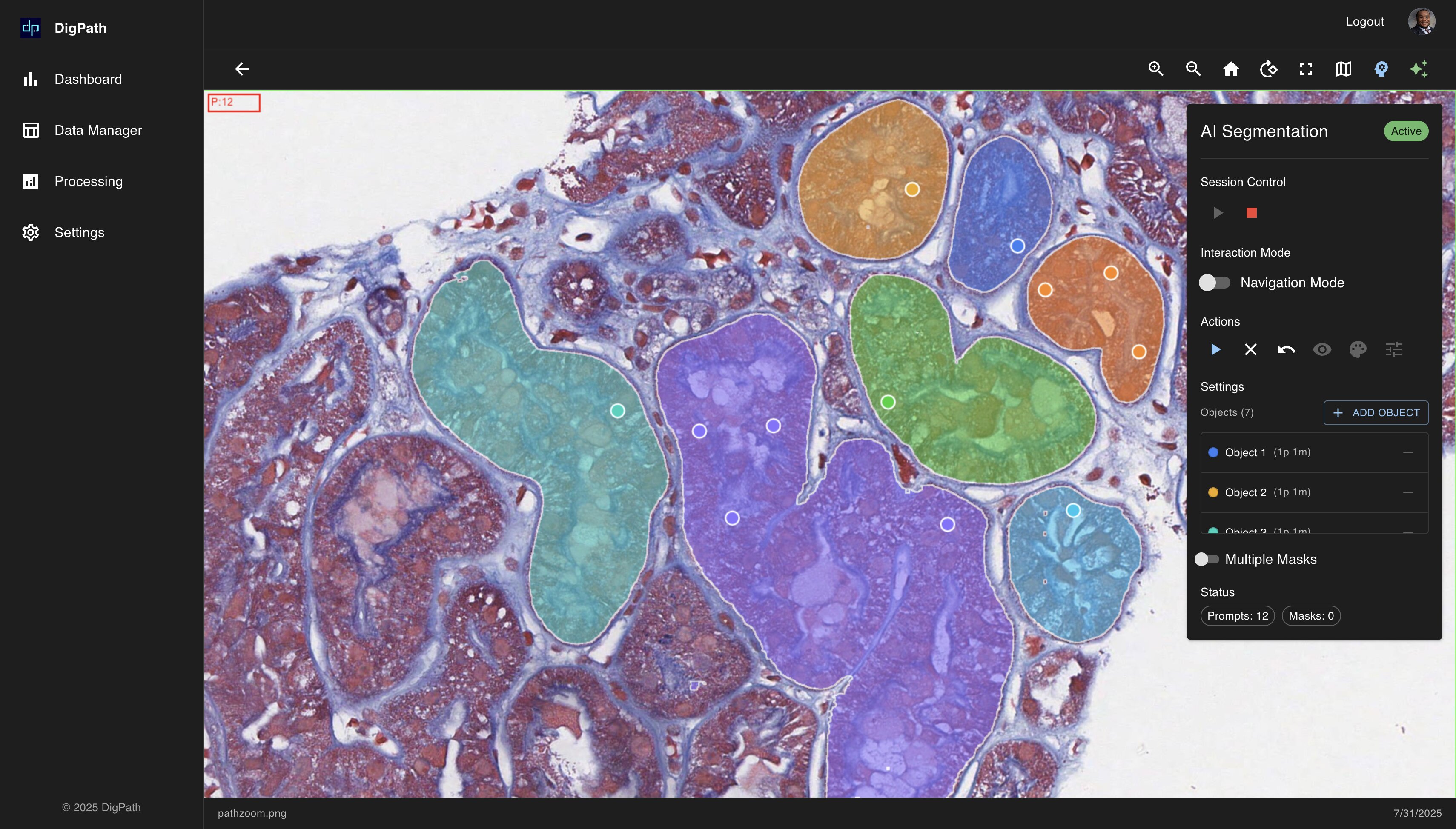 AI Tissue Segmentation - Advanced tissue structure analysis