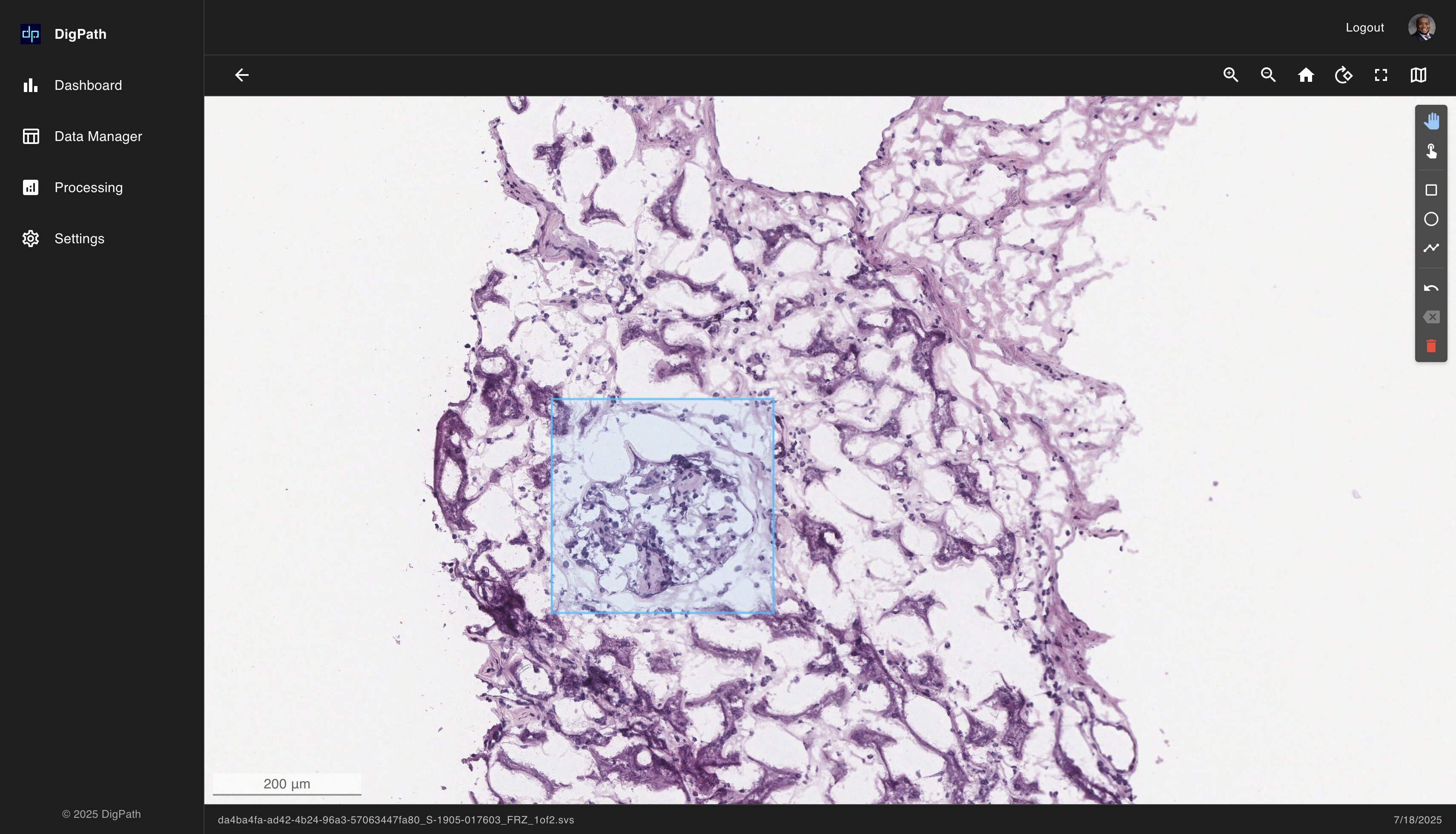 DigPath Kidney Frozen Section - High-resolution pathology analysis
